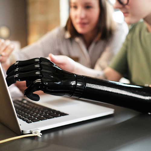 Close-up of woman with prosthesis arm pointing at monitor of laptop and discussing with her colleague at office desk