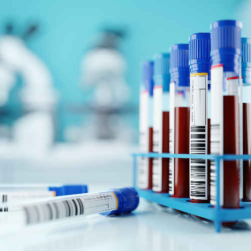Lab results confusing? Some patients use AI to interpret them, for better or worse